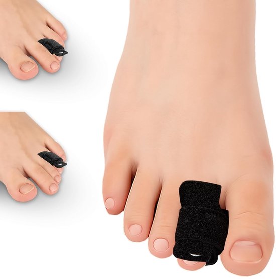 Aanpasbare hamerteen corrector set van 2 | Teenspreader voor gebroken tenen, rechtzetten van tenen en ondersteuning bij kromme voeten