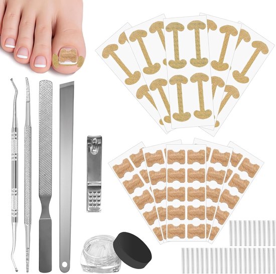 Set voor het corrigeren van ingegroeide teennagels met nagelsteun en pleisters voor grote tenen
