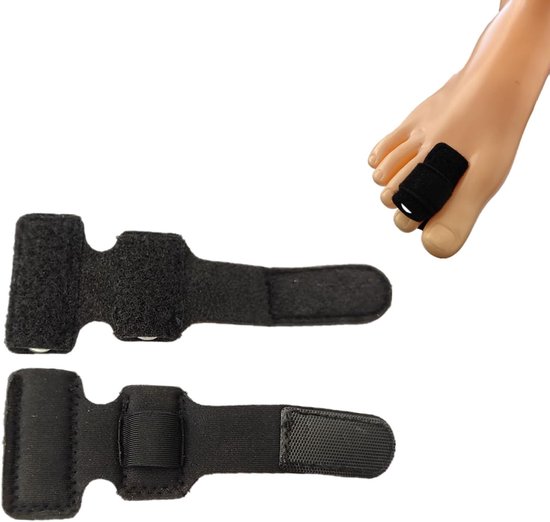 Zwarte teenrails voor hamertenencorrectie, teenbescherming en ondersteuning bij artritis, 2 stuks